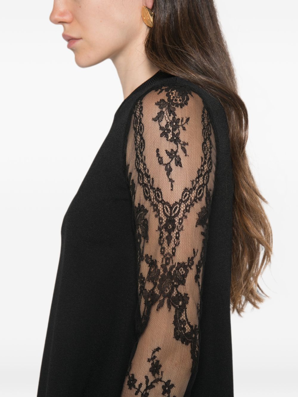 LACE DETAIL MINI DRESS